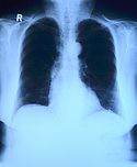 The Power of Artificial Intelligence in Healthcare The Power of Artificial Intelligence in Healthcare