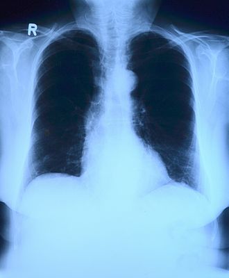 Radiology (Chest X-ray) application