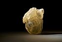 Stampante 3D per medicale Stampante 3D per medicale