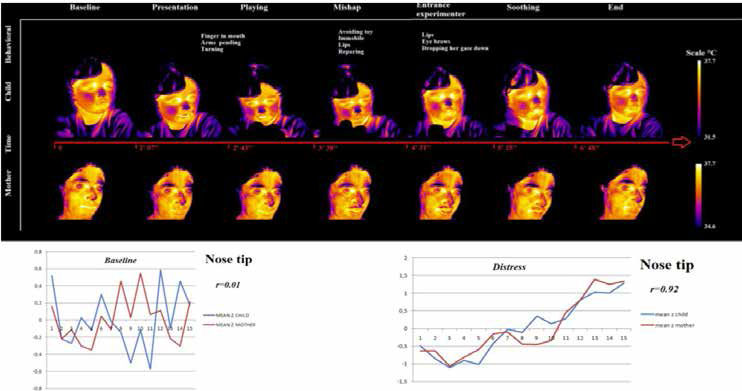 Facial thermal imprints of a mother-child dyad and nose tip temperature synchronization during distressing situation (Adapted from Ebisch, 2012)